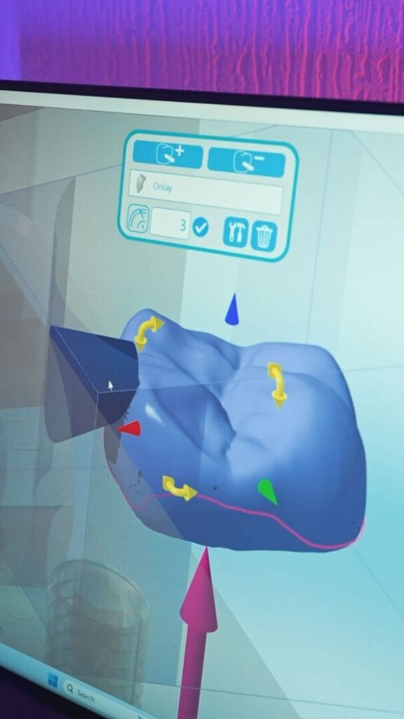 Home 14 Digital workflow Laboratory