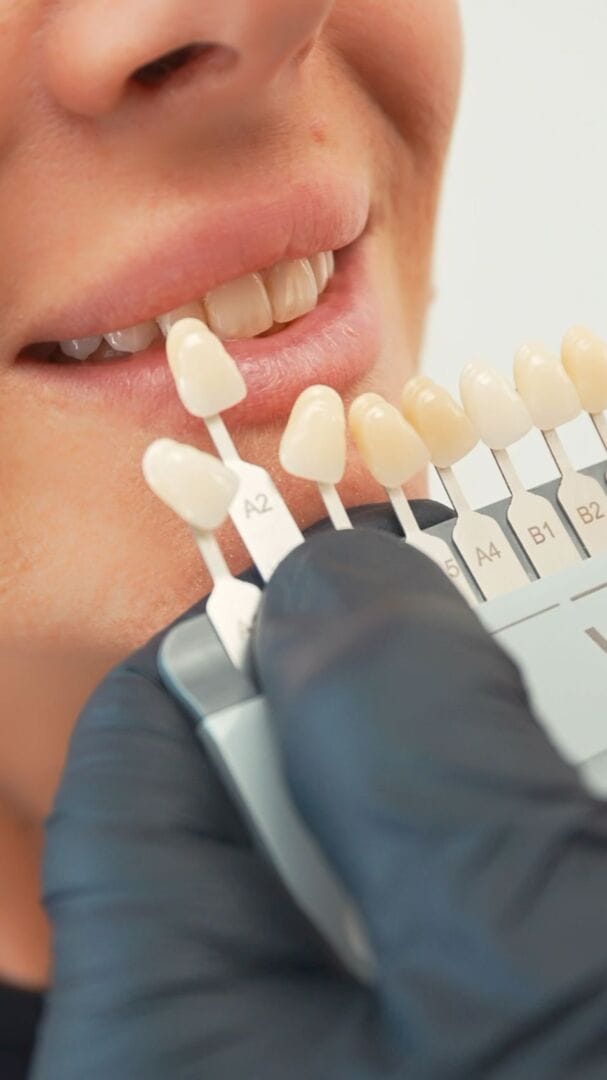 Aesthetics 1 aesthetic dentistry supplies