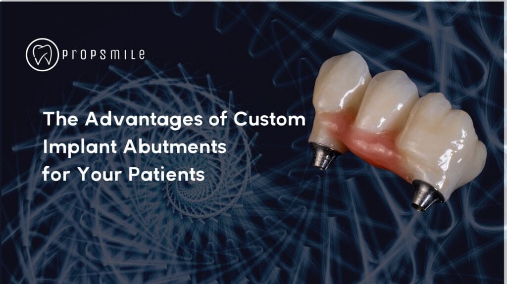 custom implant abutments