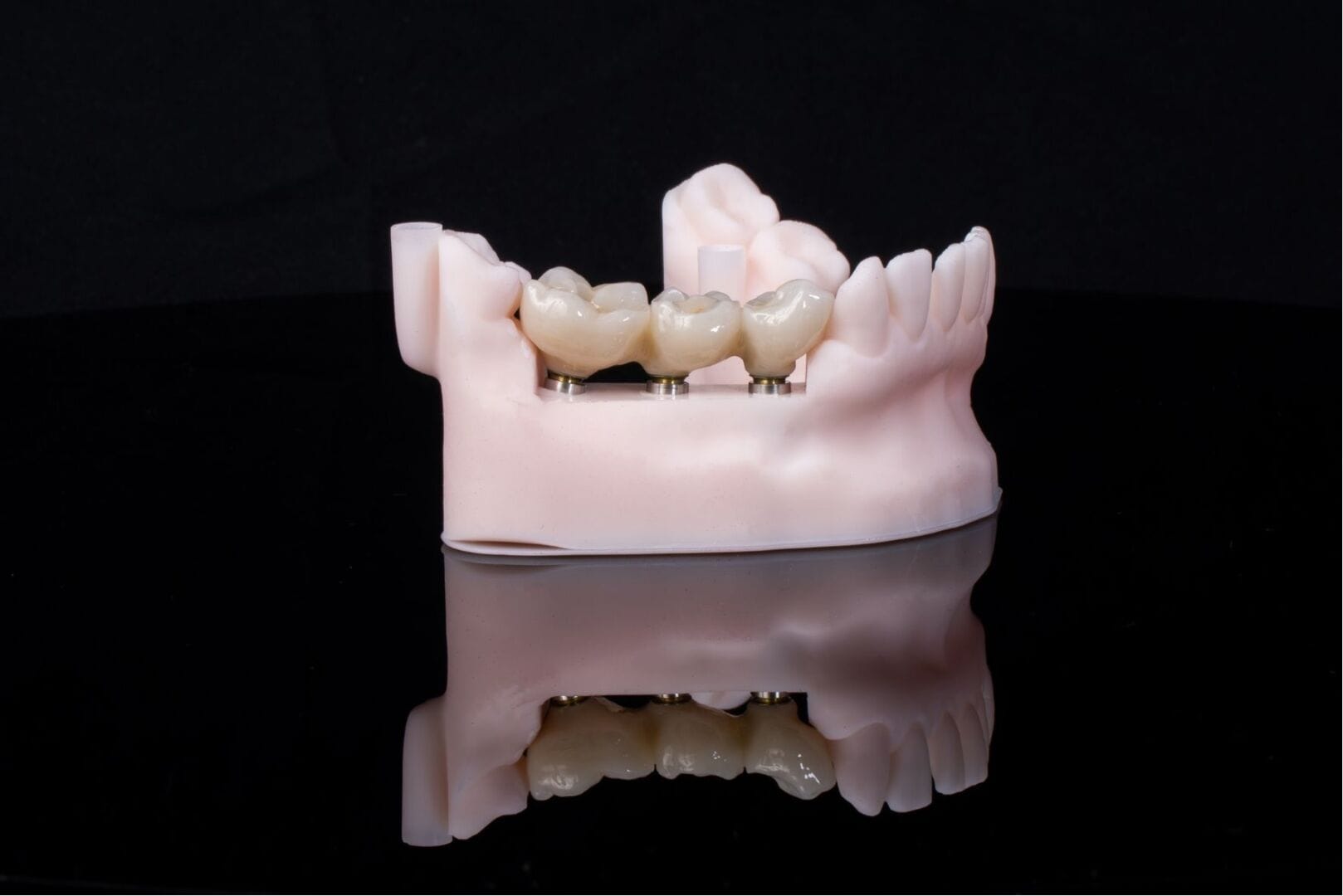 Other services 1 Digital dental Laboratory in Wimbledon