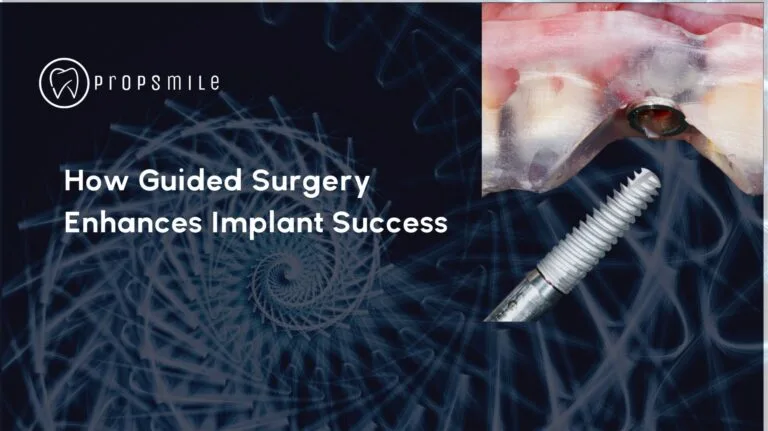 Propsmile - Brand Guidelines (7) Guided Surgery Dental Lab
